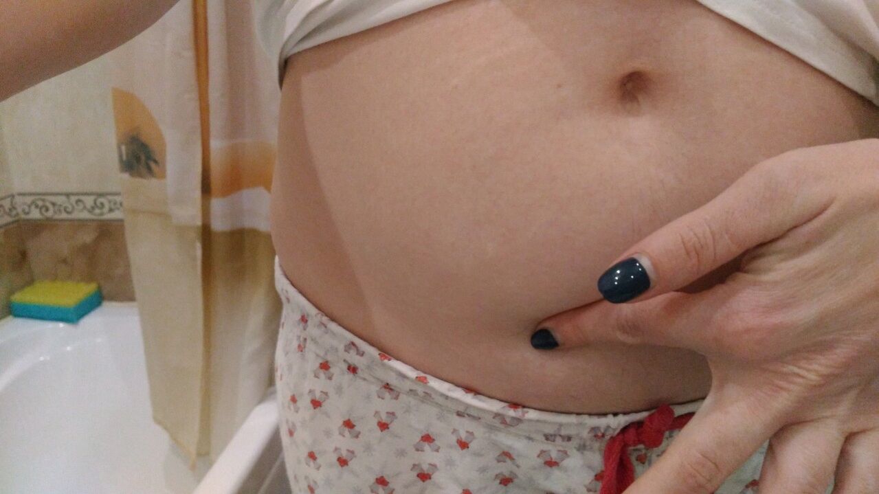 A helminth fertőzés jelei személyes tapasztalatból