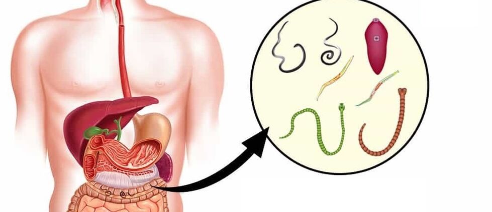 Paraziták az emberi szervezetben