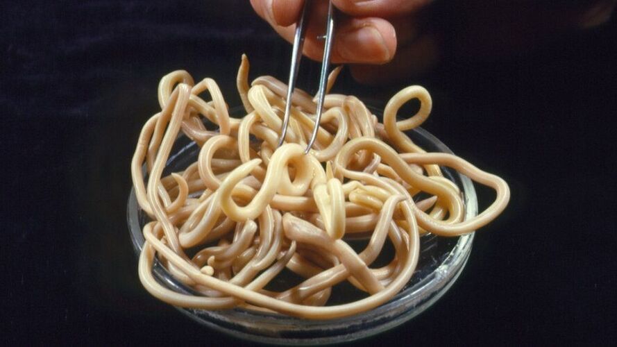 paraziták az emberi testből