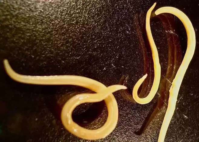 protozoon parazita az emberi testből